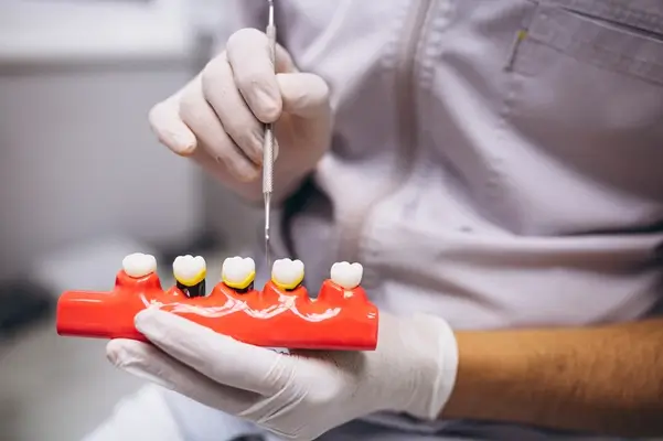 Ceramic Crowns