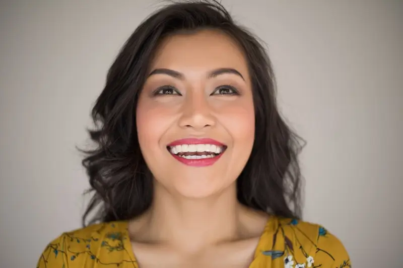 Smile Makeover Veneers