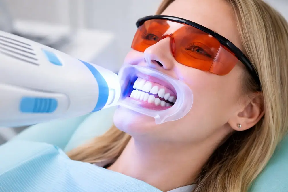 Teeth Whitening
